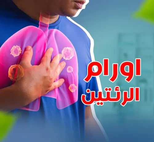 جراحات استئصال أورام الرئة والصدر مع الحفاظ على الأنسجة السليمة
