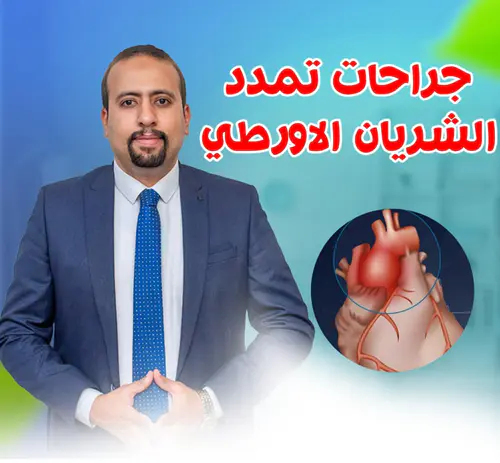 جراحات علاج تمدد الشريان الأورطي الصدري والبطني