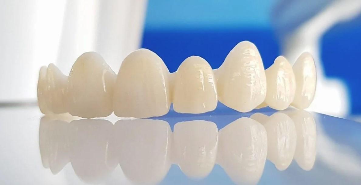 الدكتور محمد عصفور يوضح الفرق بين تركيبات الاسنان وزراعه الاسنان وايهما افضل