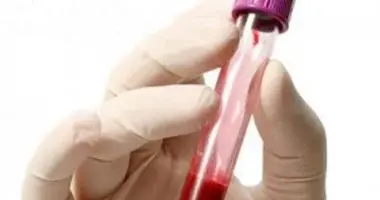 موافقة FDA على علاج جيني جديد لعلاج مرض نقص التصاق الكريات البيضاء لدى الأطفال
