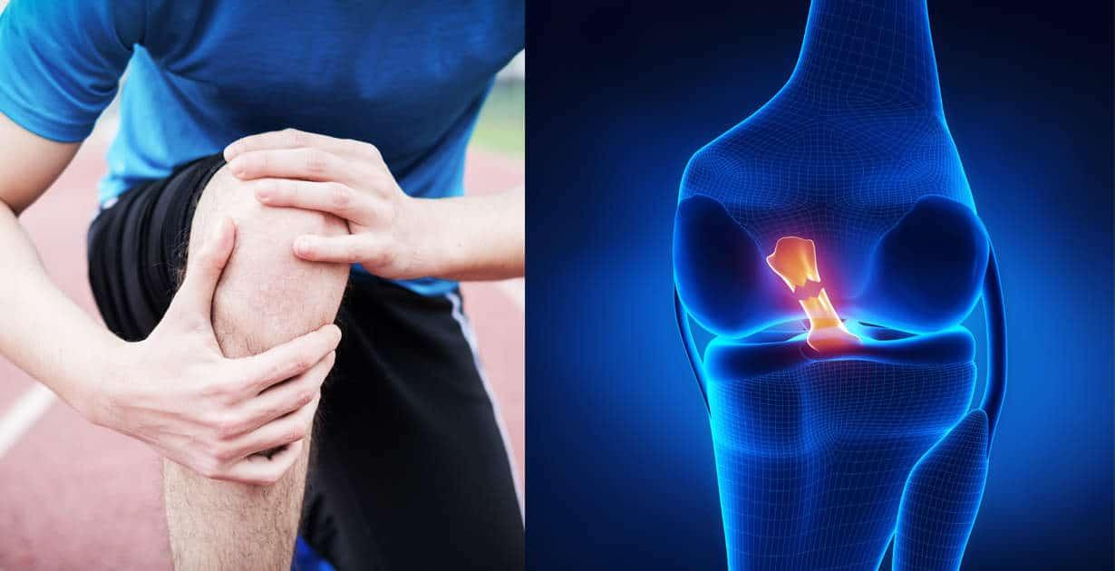 طقطقة العظام المفاجئة أسبابها وعلاجها وطرق الوقاية من مشاكل المفاصل
