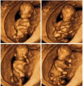 الأشعة رباعية الأبعاد