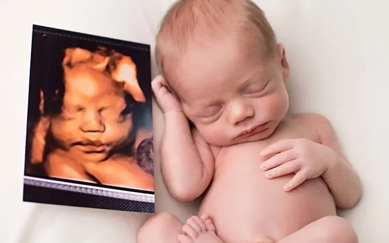 صورة للأشعة رباعية الأبعاد للحامل تُظهر الجنين داخل الرحم بوضوح