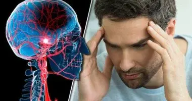 عوامل خطر تكرار السكتة الدماغية بعد التعافي مثل ضغط الدم والتدخين وأمراض القلب