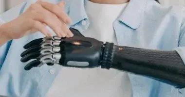 ذراع اصطناعية متطورة تعتمد على مستشعر عضلي واحد للتحكم في الحركة