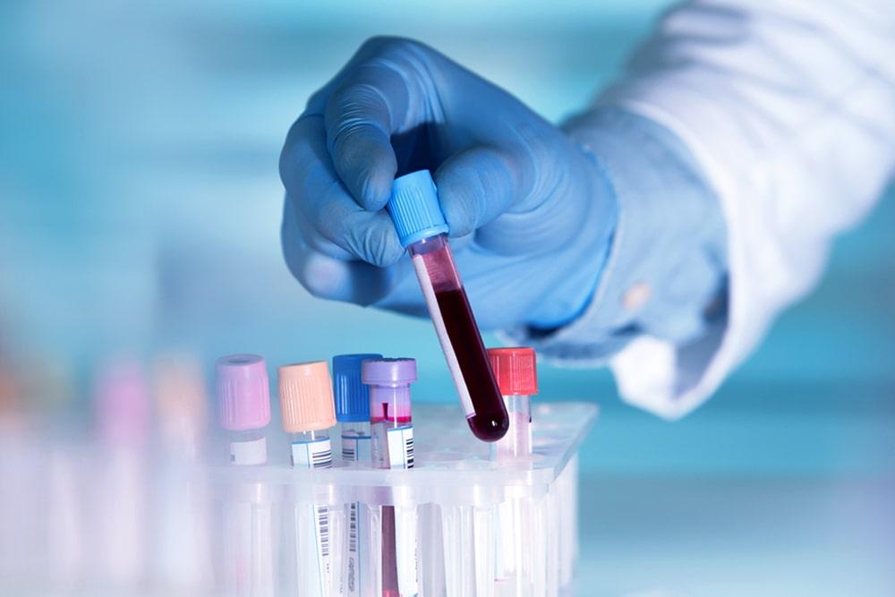 معمل النور للتحاليل الطبية في مدينة الشروق يقدم خدمات تحاليل دقيقة ونتائج موثوقة