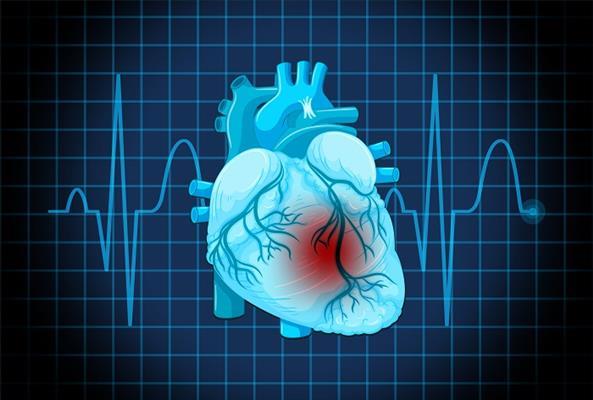 Person experiencing irregular heartbeat shown with ECG heart rhythm monitor