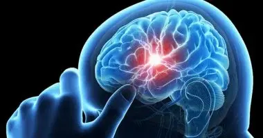 علامات الجلطة الدموية وأعراضها الخطيرة وكيفية التعرف عليها مبكرًا