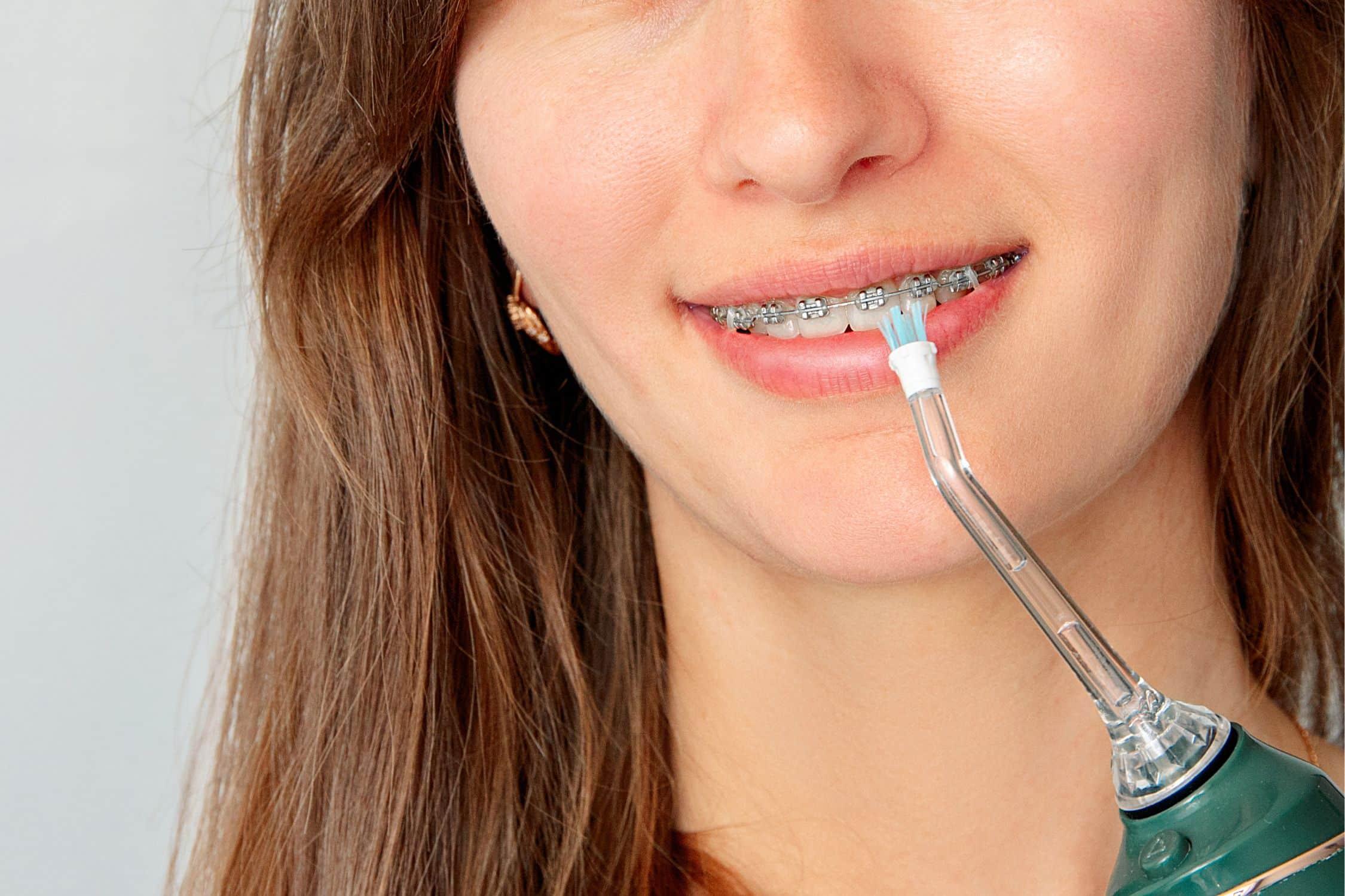 نصائح طبية مهمة بعد إزالة التقويم