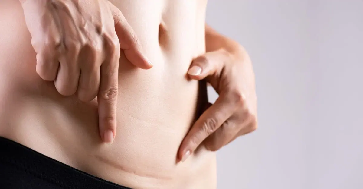 متى يكون القيصري ضروري؟ أهم الحالات