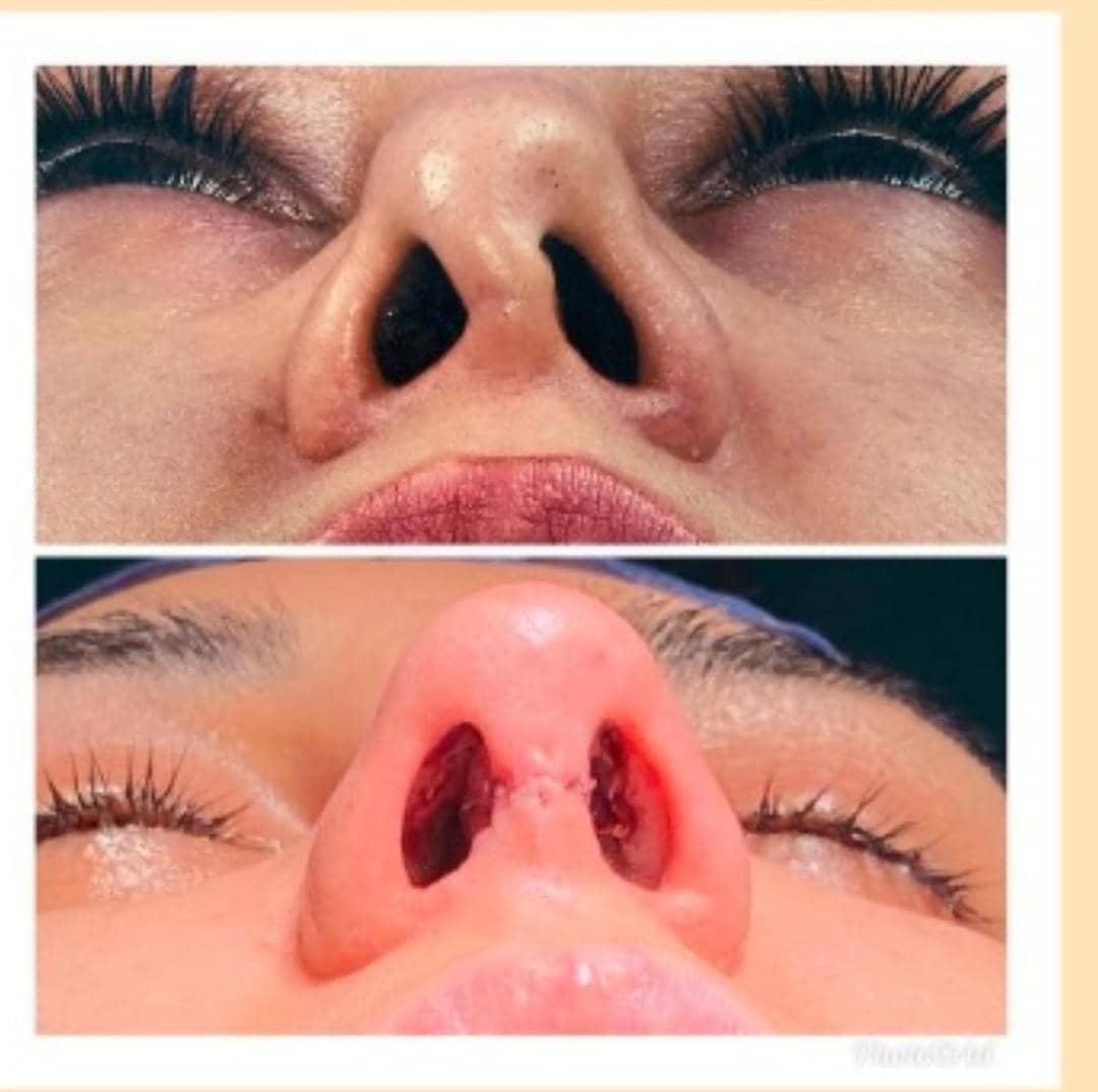 التجميل الترميمي