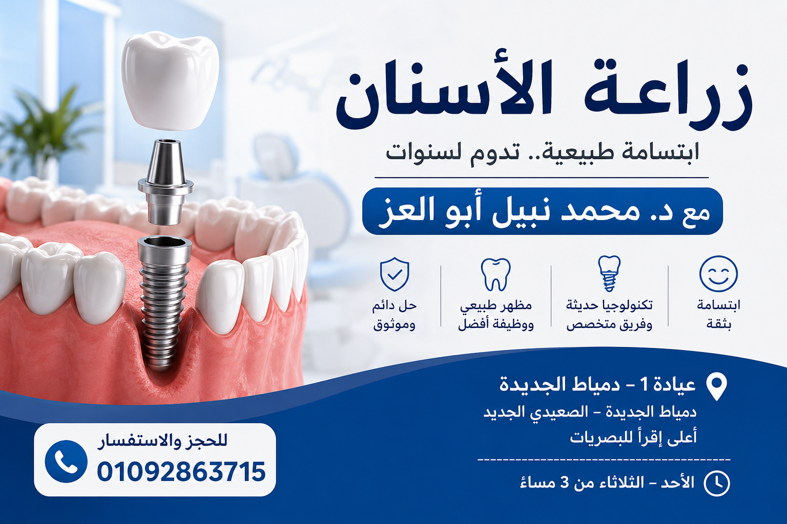 زراعة الاسنان ابتسامة طبيعية تدوم لسنوان