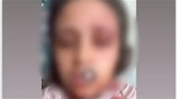 جانب من الواقعة