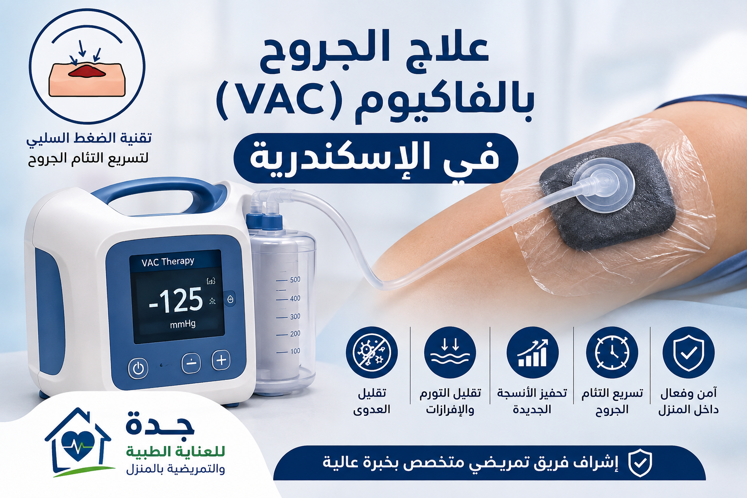 علاج الجروح بالفاكيوم
