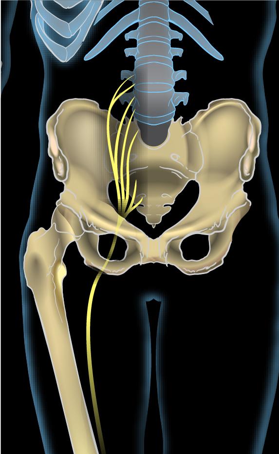 Sciatica Treatment Doctor in 6th October