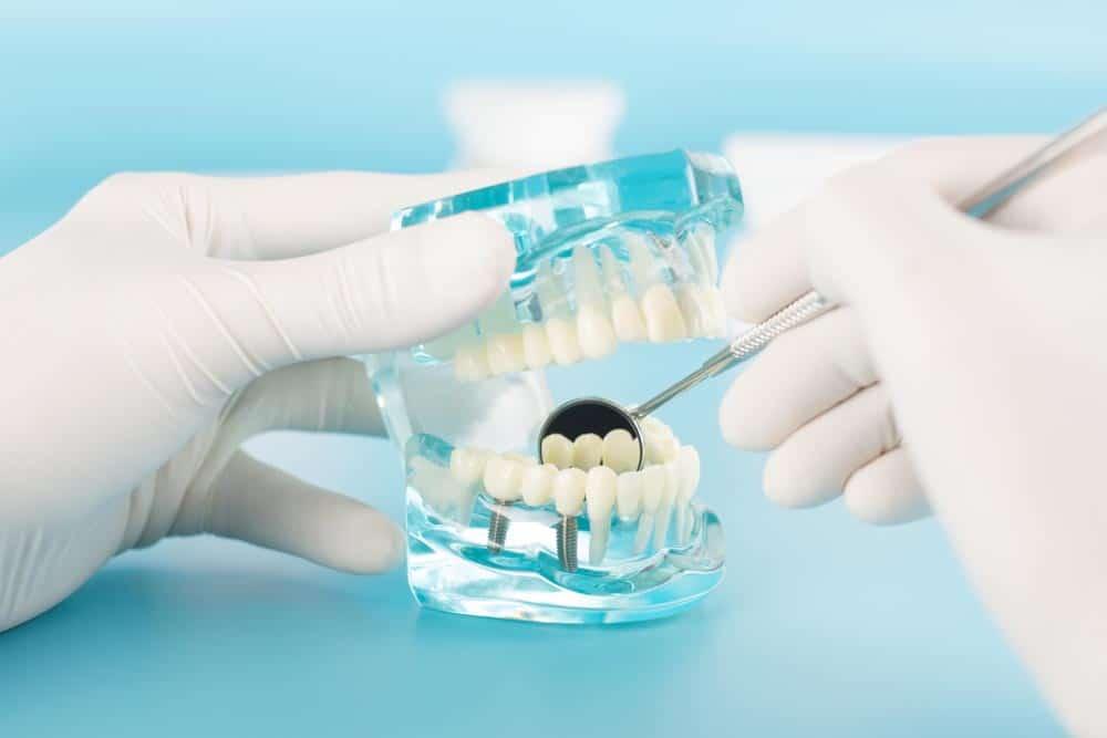 Cosmetic Dentistry and Dental Implants in Mohandessin Cosmetic dentistry and dental implants in Mohandessin