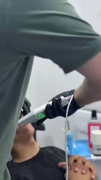 تركيبات الزيركون والـ Intraoral Scanner