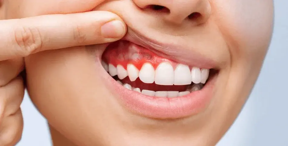 دكتورة علاج اللثة في المهندسين 