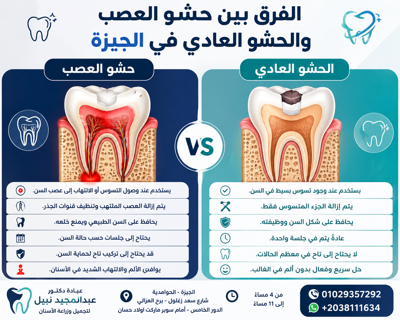 الفرق بين حشو العصب والحشو العادي