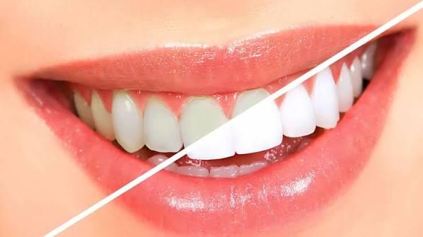 Dentist Specialized in Cosmetic Dentistry in Beheira