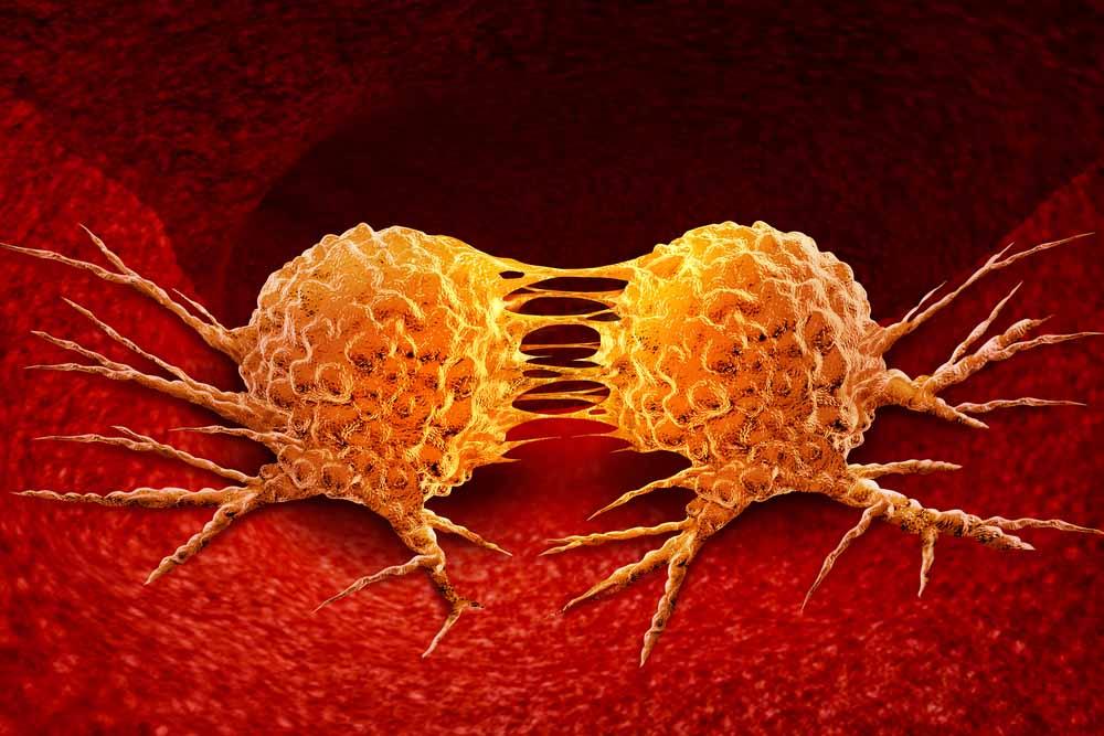 دكتور متخصص في استئصال الاورام الحميده في طنطا