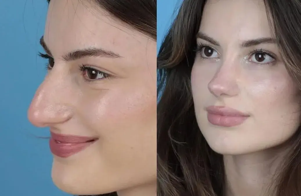 جراحات تجميل الوجه والأنف