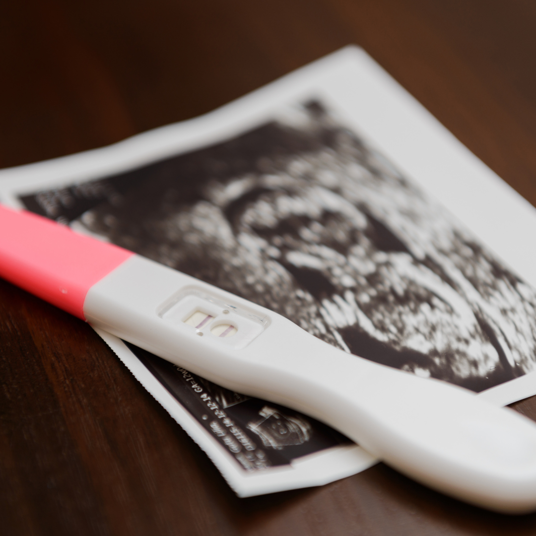Infertility Treatment in Suez