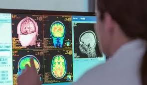  الدماغ البشري يستمر في التطور حتى سن 32