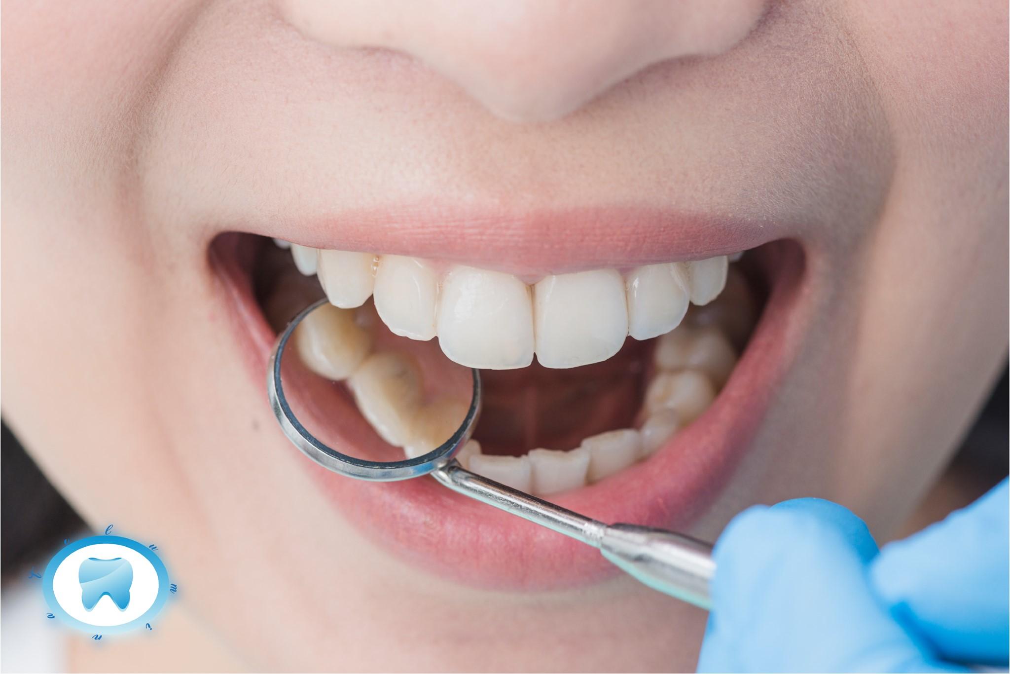 عيادة أسنان متخصصة في حلمية الزيتون تقدم خدمات علاج وتجميل الأسنان بأحدث التقنيات