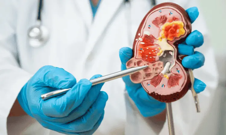 "صحة الكلى للنساء بعد الأربعين"