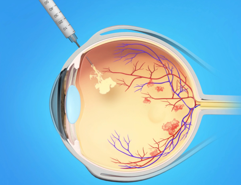لدكتور عماد تركماني