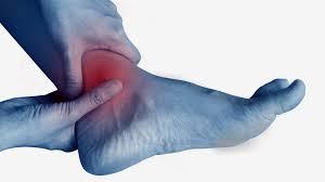 تورم الكاحلين قد يكون علامة على مشاكل في القلب أو الكلى أو الكبد