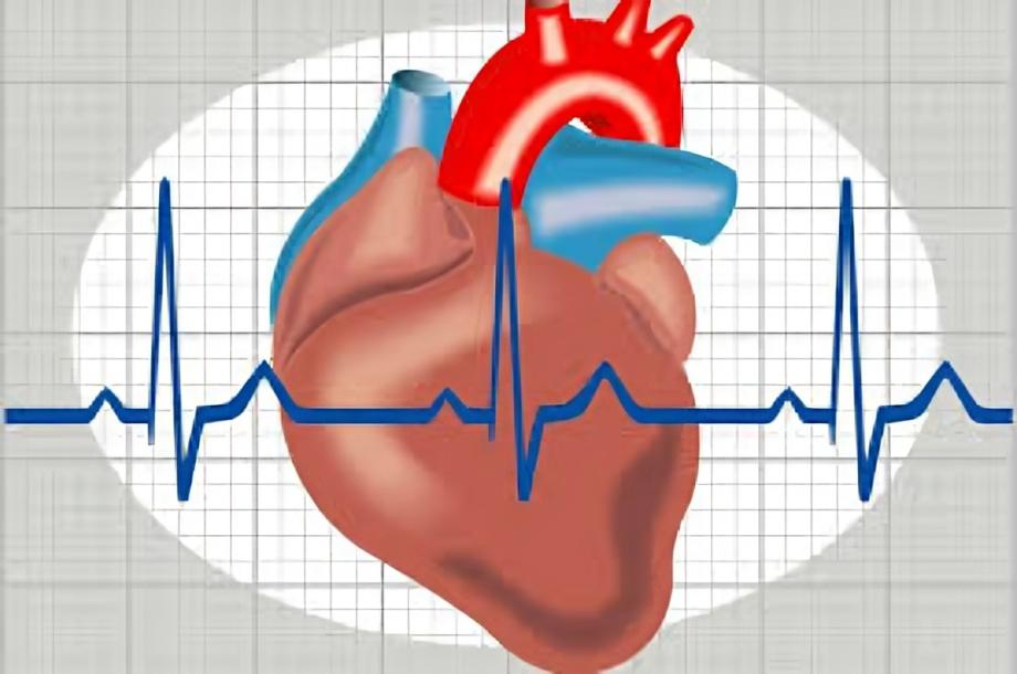 اضطرابات نظم القلب