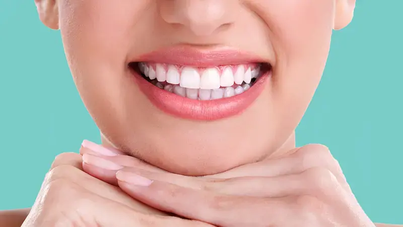 تجميل الأسنان بدون تقويم في عيادة سلامتك – مدينة نصر