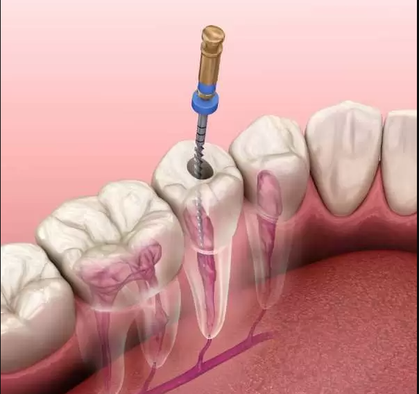 عيادة برايتي