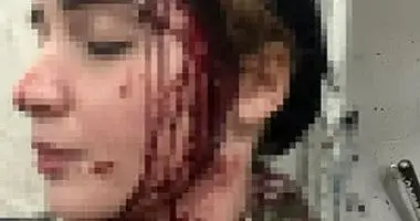 محكمة الطفل تستعد لمحاكمة المتهم بتشويه فتاة في العجوزة