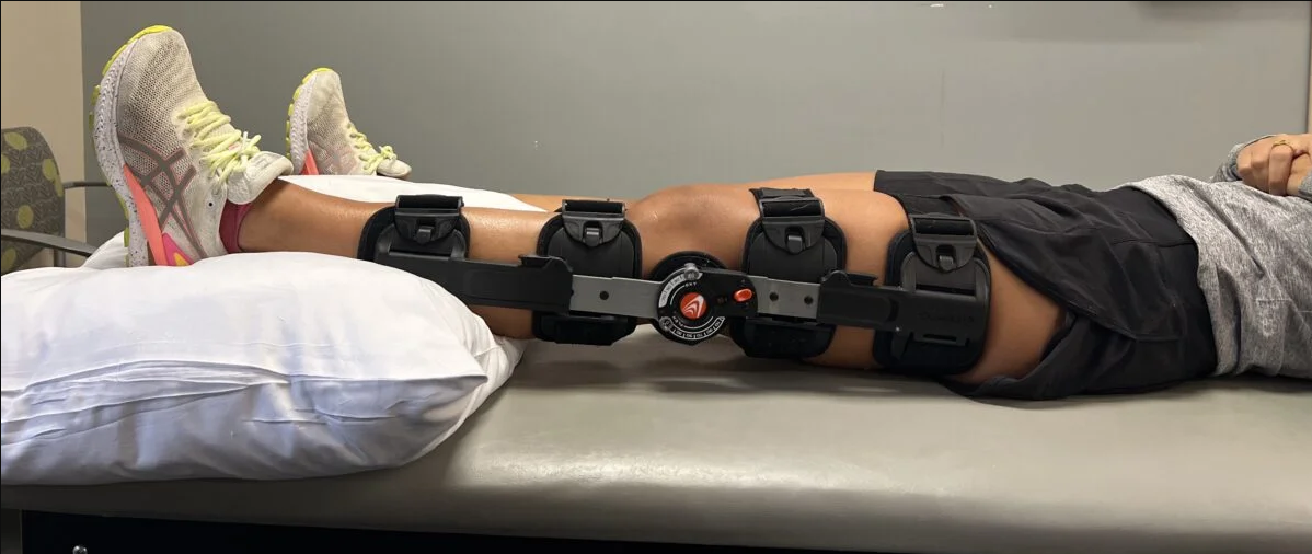 ACL Recovery Stages