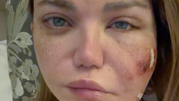 ياسمين الخطيب بعد إعلان إصابتها بعدوى بكتيرية وخضوعها لجراحة دقيقة في الوجه