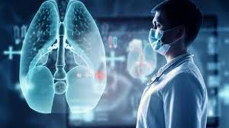 الذكاء الاصطناعي يساعد في الكشف المبكر عن سرطان الرئة عبر الأشعة