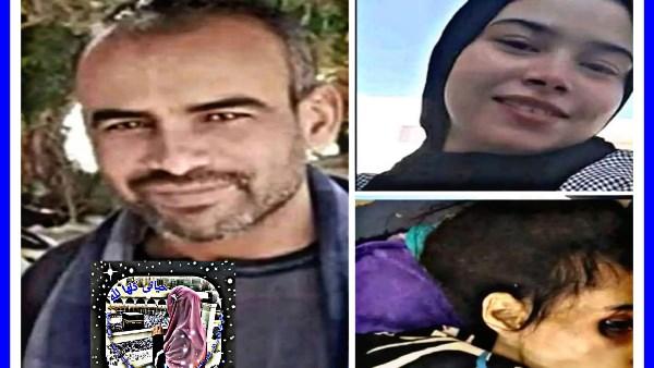 صورة توضيحية للجوع وتأثيره على الجسم