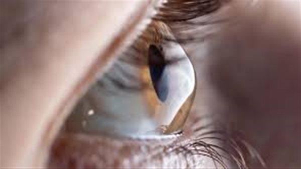 الجلوكوما وارتفاع ضغط العين يهددان البصر في بريطانيا