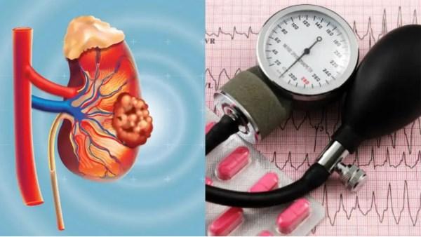 صورة تحذيرية عن ارتفاع ضغط الدم وخطر سرطان الكلى مع رمز تنبيه