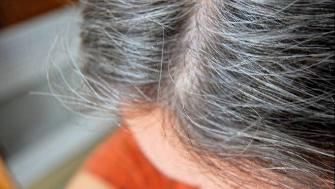 شخص يمسك خصلة من شعره الأبيض المبكر مع رسمة توضيحية لأسباب الشيب المبكر.