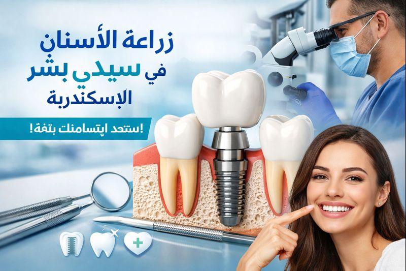 زراعة أسنان الإسكندرية