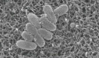 ارتفاع إصابات السعال الديكي في ولاية فلوريدا الأمريكية