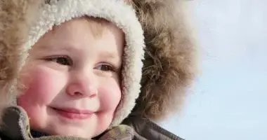 أسباب جفاف بشرة الأطفال في فصل الشتاء