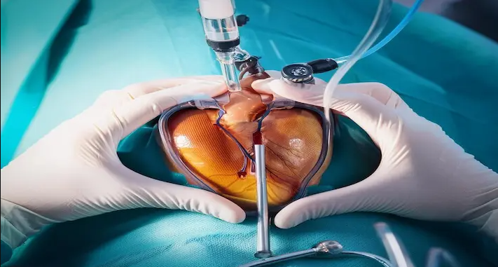 When Cardiac Catheterization Is Needed