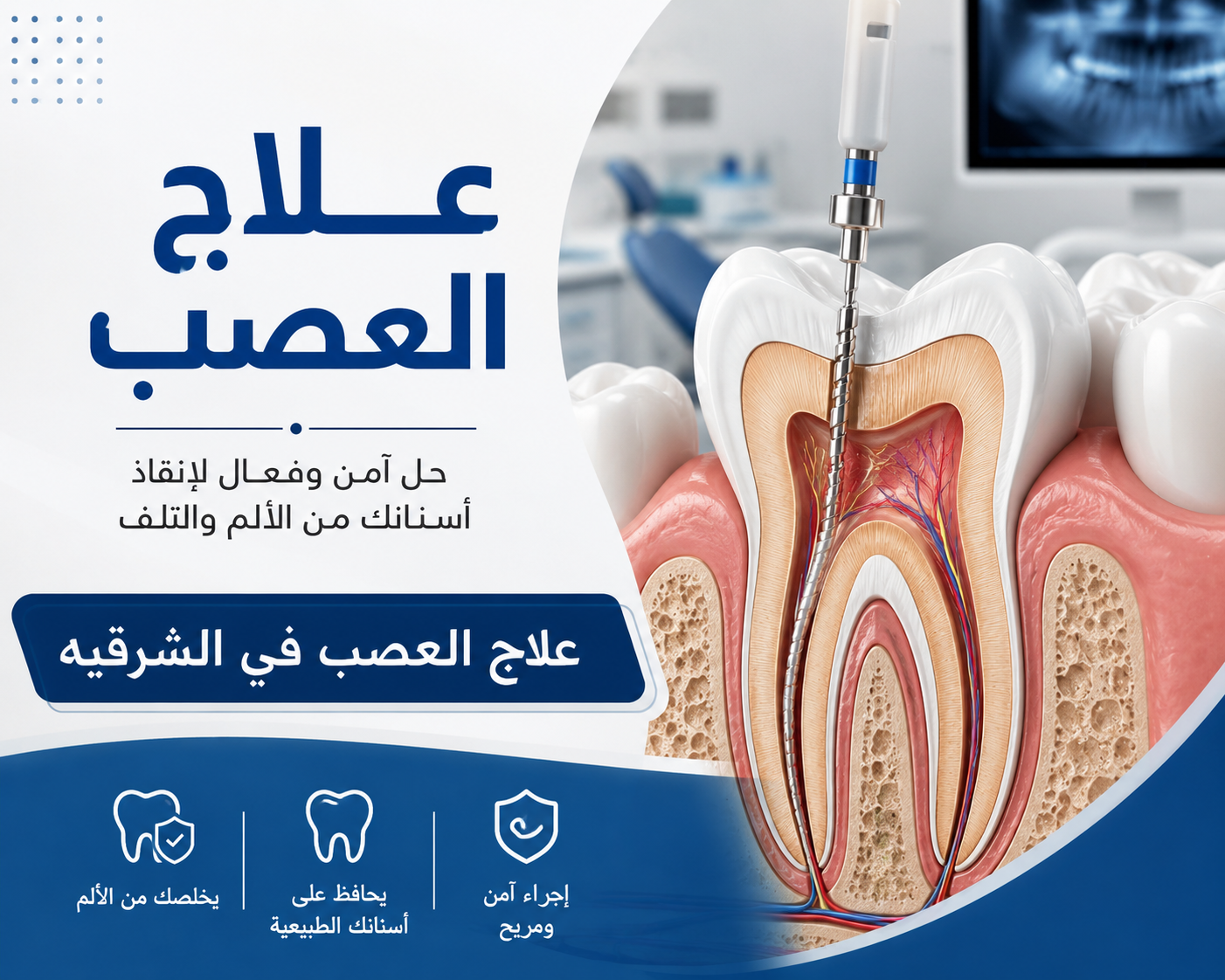  علاج العصب في الشرقيه