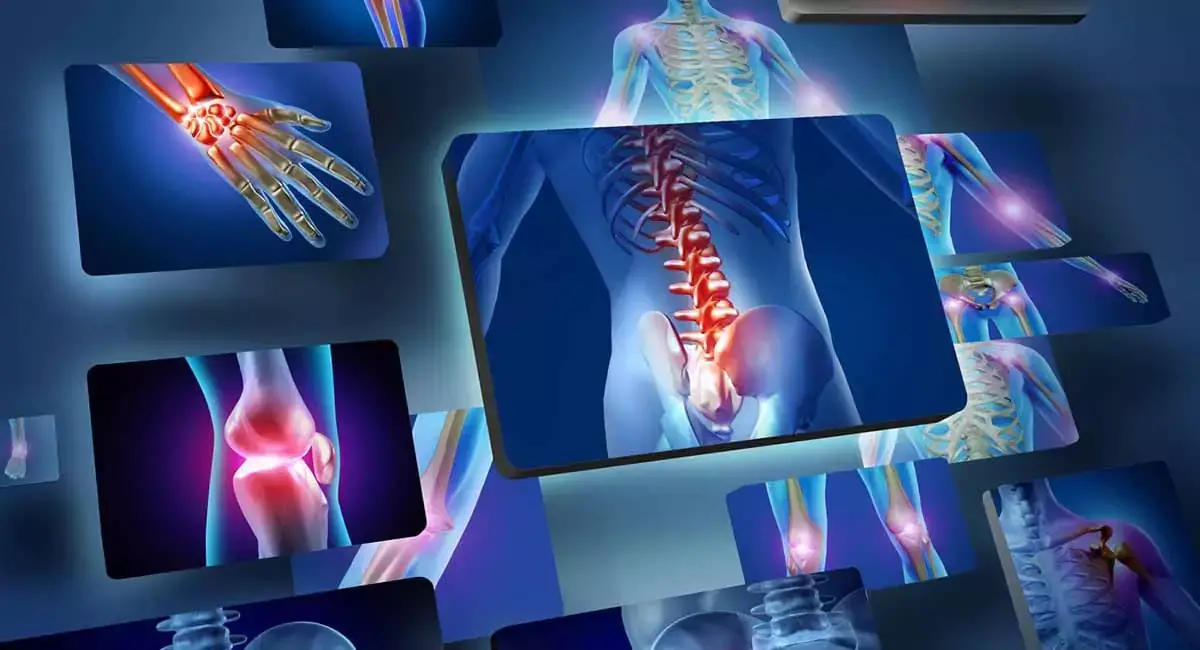 علاج التهاب المفاصل والروماتيزم