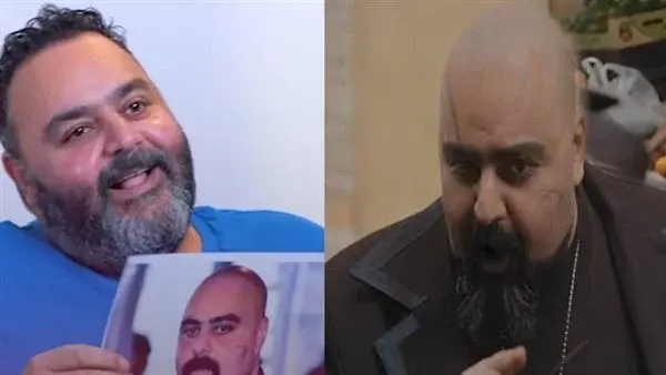 شيكو